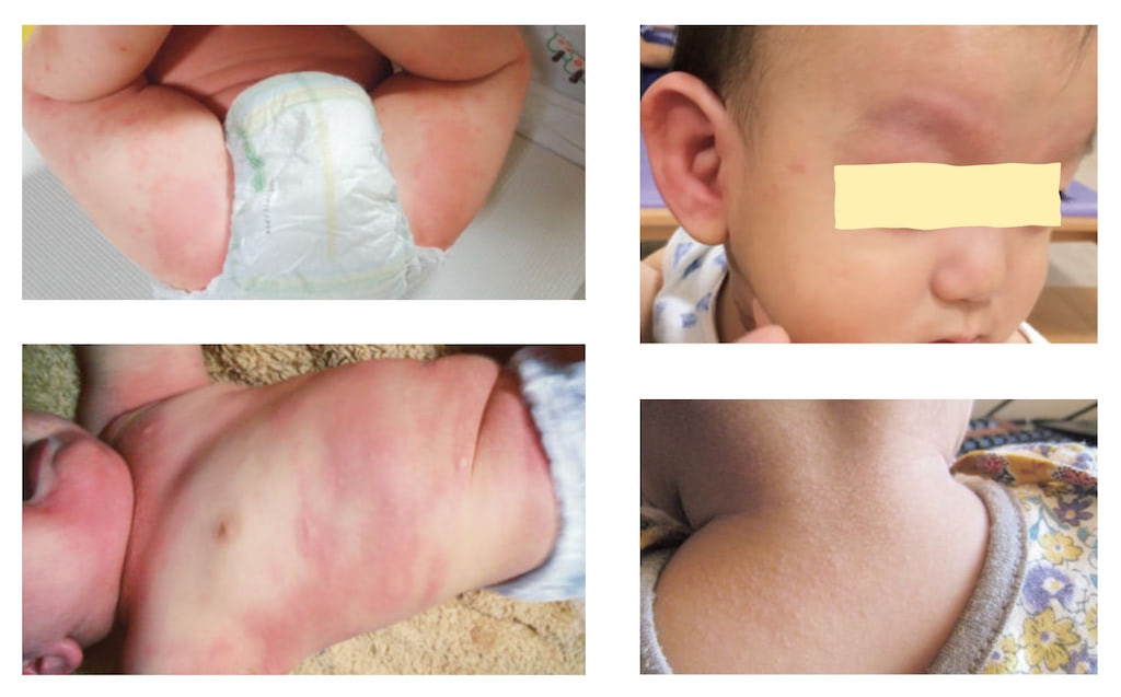 医師の診察を受ける時期